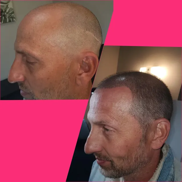 iBrow Vixen transformation result