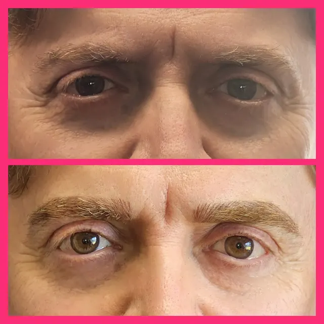 iBrow Vixen transformation result