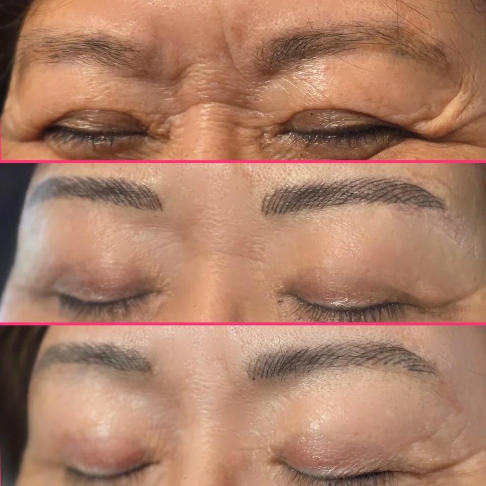 Nano Machine Hair Strokes fresh and healed result example 2