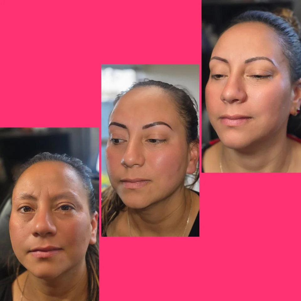 Nano Machine Hair Strokes fresh and healed result example 3